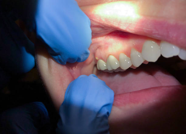 Best Urgent Care for Lost Fillings or Crowns in Dallas, OR
